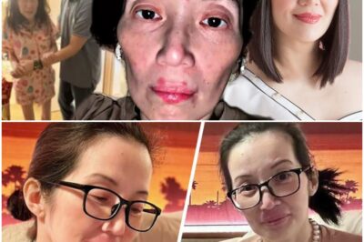 GRABE! ITO PALA ANG TUNAY NA KALAGAYAN NI KRIS AQUINO! 1 MILLION A DAY SA HOSPITAL!