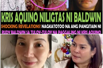 SHOCKING!🔴Pangitain ni RUDY BALDWIN na tuloy-tuloy na ang paggaling ni KRIS AQUINO, nagkatotoo na!