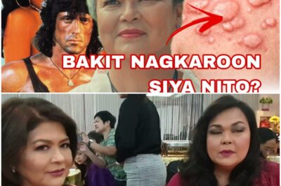 DATING SIKAT NA BOLD STAR TETCHIE AGBAYANI, BAKIT NAGKAROON NG GANITONG SAKIT?